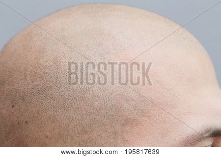 professional tattooist making permanent make up tricopigmentation