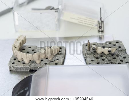 Mplants Teeth Made In The Technic Opaque Porcelain Dental. Oxidized Metal Opaque.