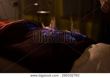 Chinese Fire Massage - Huo Liao Therapy. Traditional Chinese Medicine, Fire Treatment And Bodycare C