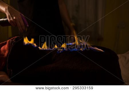 Chinese Fire Massage - Huo Liao Therapy. Traditional Chinese Medicine, Fire Treatment And Bodycare C