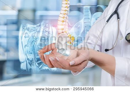 A Doctor Is Holding An Artificial Spine Model With Pelvis Unite With The Digital Spine Image At The 