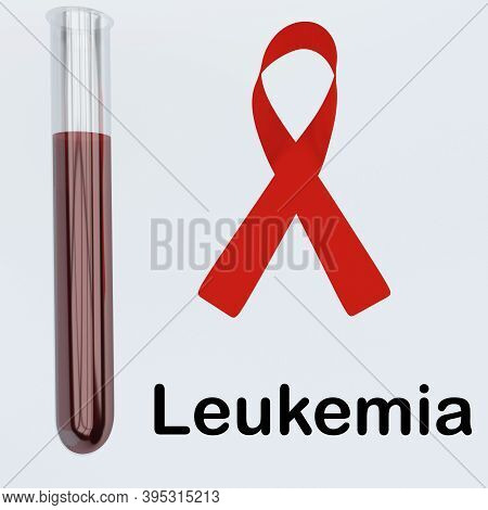 3d Illustration Leukemia Script Below An Awareness Ribbon Of Lung Cancer And Human Lungs, Isolated O