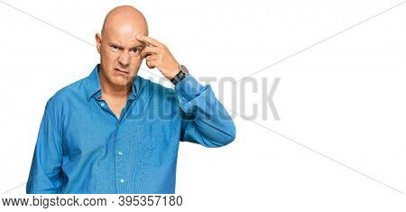 Middle age bald man wearing casual clothes pointing unhappy to pimple on forehead, ugly infection of blackhead. acne and skin problem 