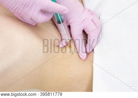Lipolytic Injections Are Placed In The Stomach. Female Hands In Pink Gloves Inject A Young Woman Int