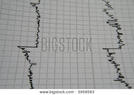 Ekg