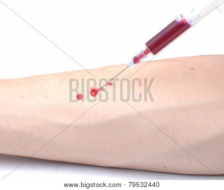 Blood Sampling With Syringe And Needle For Analysis