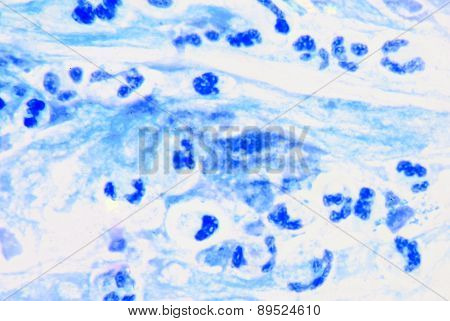 White Blood Cell.