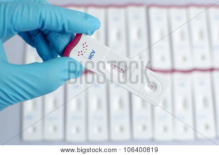 Hepatitis C virus (HCV) testing positive
