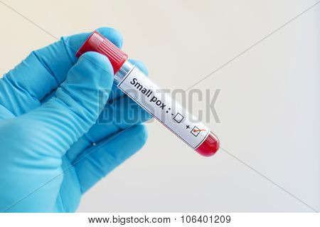 Smallpox blood sample