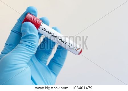 Coxsackie virus blood sample