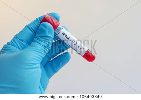 H5N1 Influenza virus