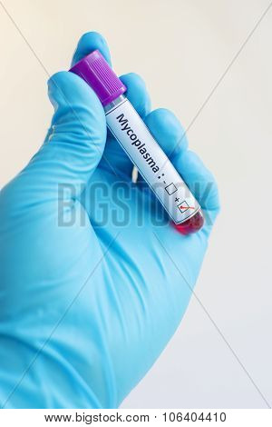 Mycoplasma blood sample