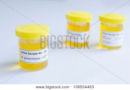 Neisseria gonorrhoeae positive