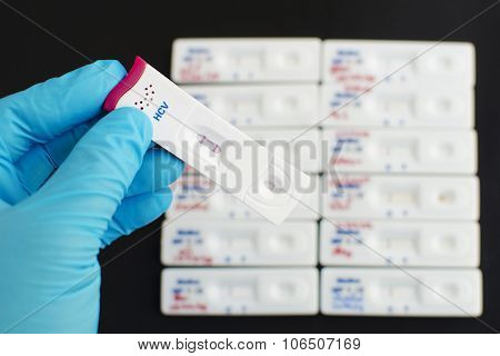 Hepatitis C virus (HCV) testing positive