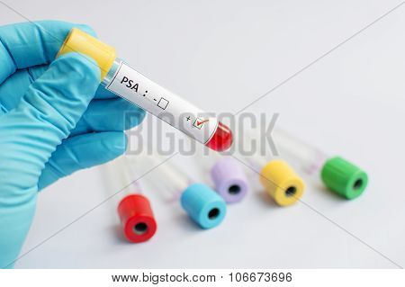 PSA blood sample