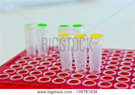 Eppendorfs In A Red Rack