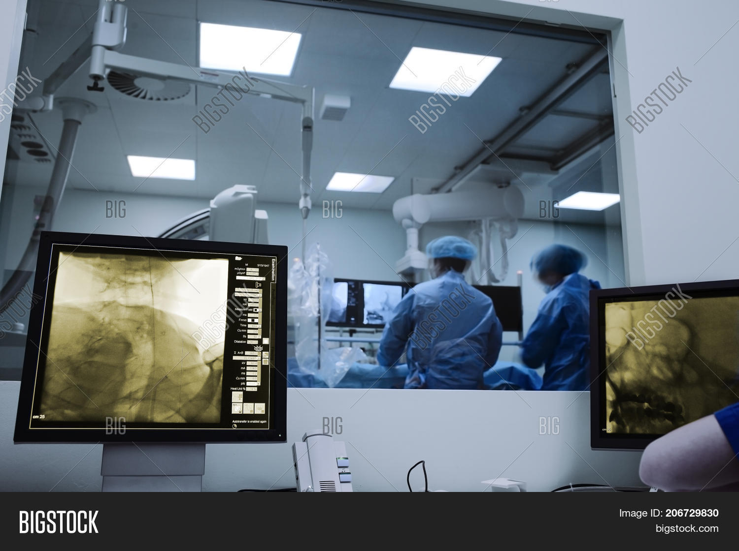 Xray Monitoring Image & Photo (Free Trial) Bigstock