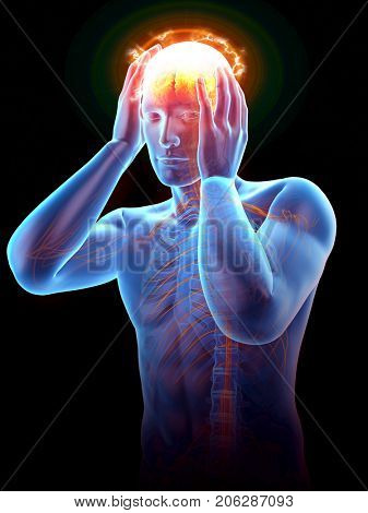 3d rendered medically accurate illustration of man having a headache