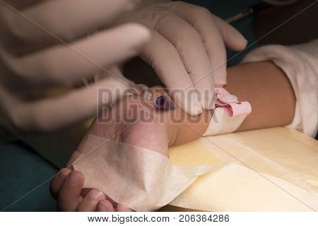 Doctor Withdrawing The Needle For Arterial  Line