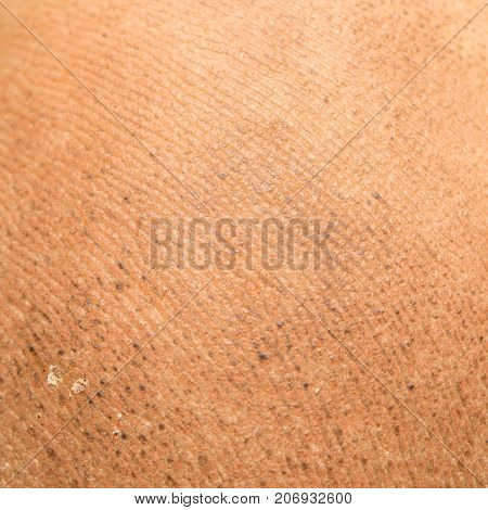 dirty background of human skin . Photo of abstract background