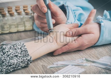 Alternative medicine therapist doing moxa treatment on her client