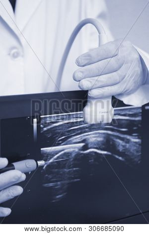 Epi Dry Needling Ultrasound Scan