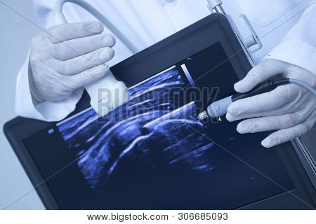 Epi Dry Needling Ultrasound Scan