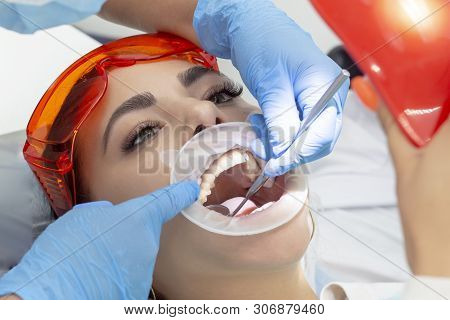 Girl On Examination At The Dentist. Treatment Of Carious Tooth. The Doctor Uses A Mirror On The Hand