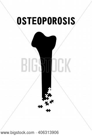 Medical Concept Of Osteoporosis Disease And Other Bone Ailments Vertical Black White Poster Bone Dam
