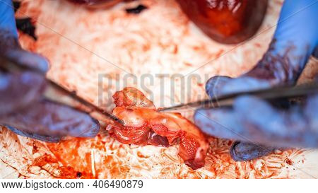 Scientist Showing The Semilunar Valves Of A Fresh Dissected Pig Heart With Scalpel And Tweezers.