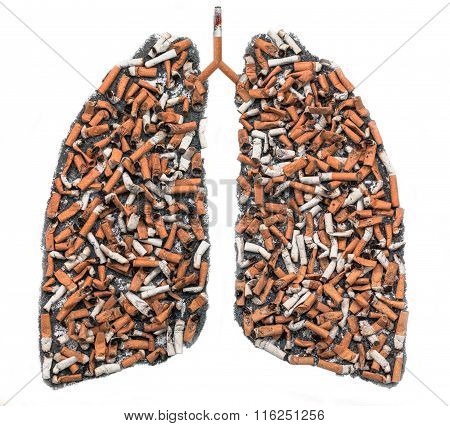 Cigarette Butts In Pulmonary Contour