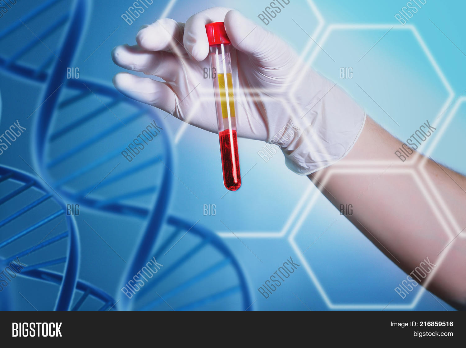 Analysis Dnk. Hand Image & Photo (Free Trial) Bigstock