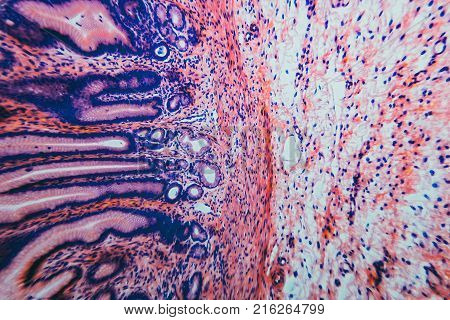 Cell Microscopic- Pyloric Division Stomach