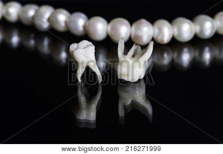 two bad rotten tooth pulled out and lie opposite the dazzling white pearls on a black isolated background