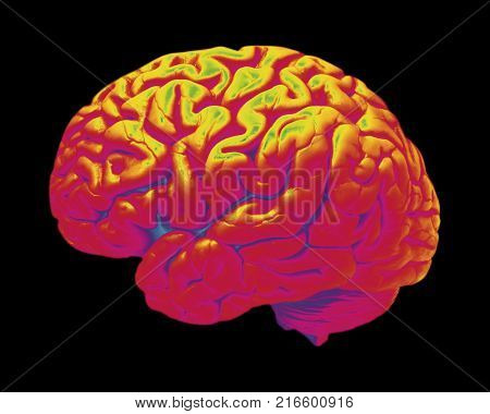 FALSE COLOUR IMAGE OF HUMAN BRAIN ON BLACK BACKGROUND