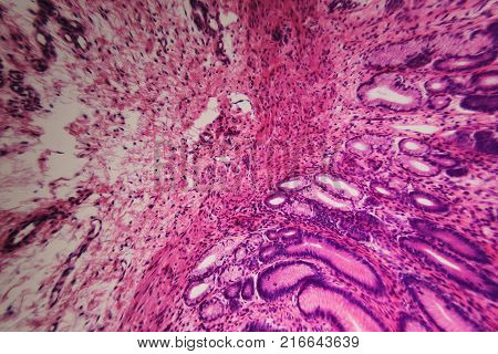 Cell Microscopic- Pyloric Division Stomach