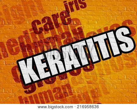Modern healthcare concept: Keratitis on Yellow Brick Wall . Keratitis - on Brickwall with Wordcloud Around .