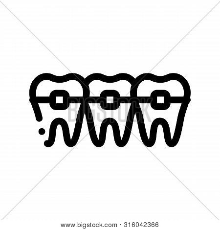 Dentist Stomatology Teeth Braces Vector Sign Icon Thin Line. Teeth Braces Bracket, Orthodontic Appli