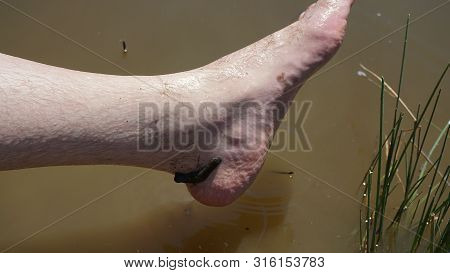 natural leech therapy, people doing leech therapy in the lake,