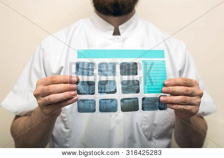 Image Of Male Doctor Or Dentist Holding And Looking At Old Dental X-ray, Analyzing