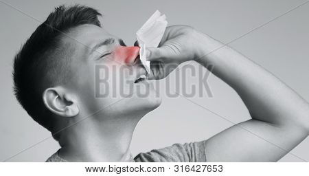 High Blood Pressure. Young Man Suffering From Nose Bleeding, Stop Blood With Tissue, Free Space