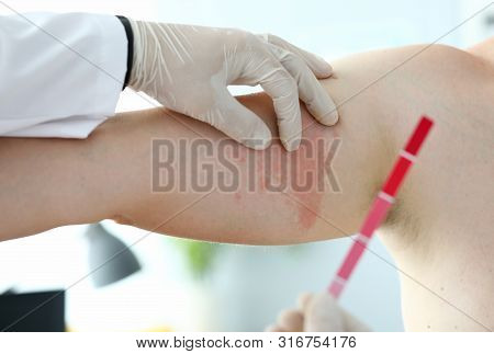 Male Doctor In White Protective Gloves Exam Patient Sexually Rare Transmitted Infections Background 