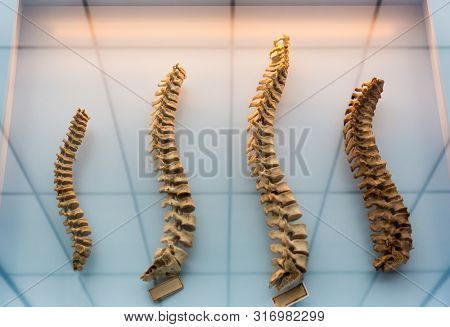 Model of a human spine, spinal columns