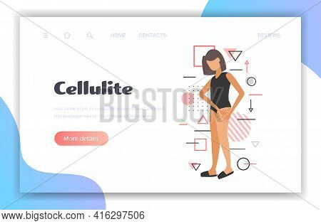 Woman Testing Skin Presence Of Stretch Marks Checking Cellulite On Her Buttock Girl Clamping Fat Fol