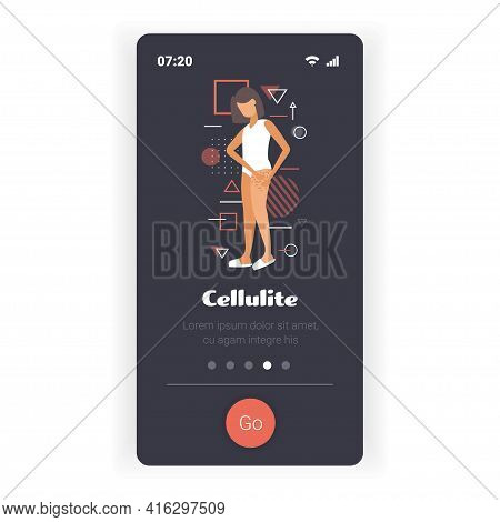 Woman Testing Skin Presence Of Stretch Marks Checking Cellulite On Her Buttock Girl Clamping Fat Fol