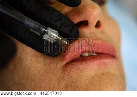 Closeup Woman Lips, Procedure Augmentation. Syringe Female Mouth, Hyaluronic Acid Injection, Augment