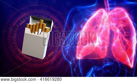 Cg Medical 3d Illustration, Human Lungs Illness By Tobaco