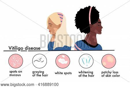 World Vitiligo Day.young Women Different Ethnicities With Skin Disease.depigmentation Problem.patchy