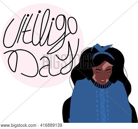 World Vitiligo Day.young Afro American Woman With Skin Disease.pigmentation Problem,white Spots.patc