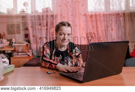 A Disabled Girl With Slanted Eyes Is Sitting At A Desk And Working On A Laptop.